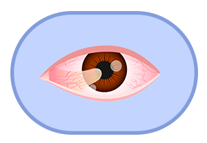 Custom icon